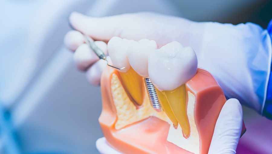 Davis Dental - Specialist Prosthodontist image