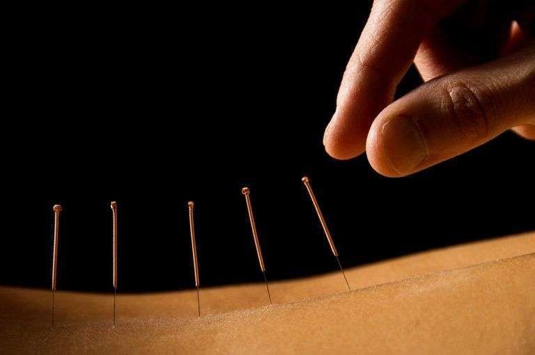 Acupuncture @ Beerwah gallery image 2